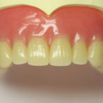 歯茎が黒いのはなぜ？4つの原因と治療法まとめ