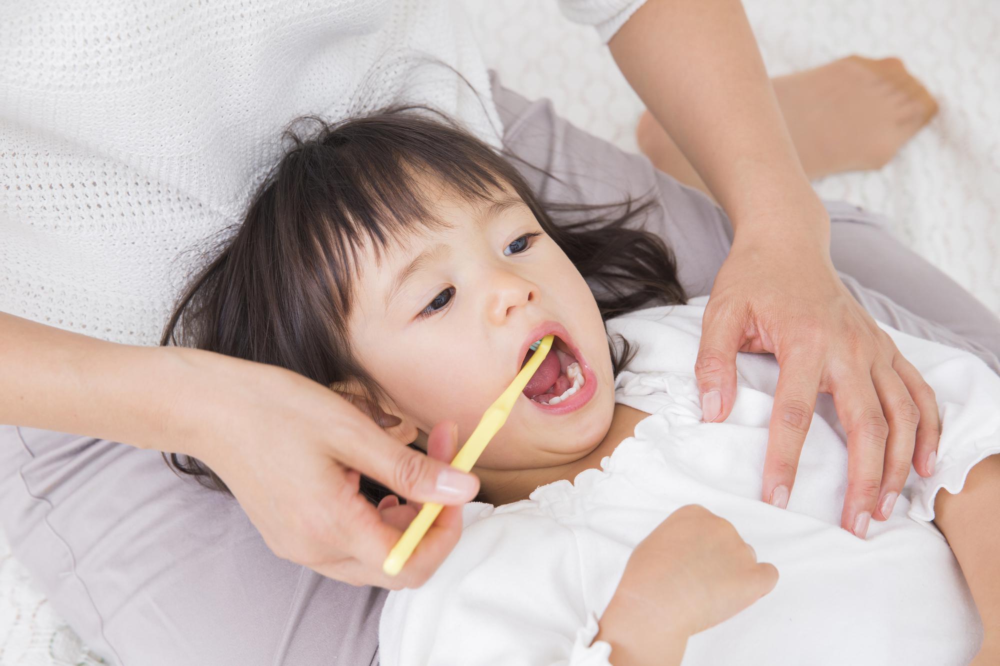 要注意 子供の虫歯は白い歯のままで進行します
