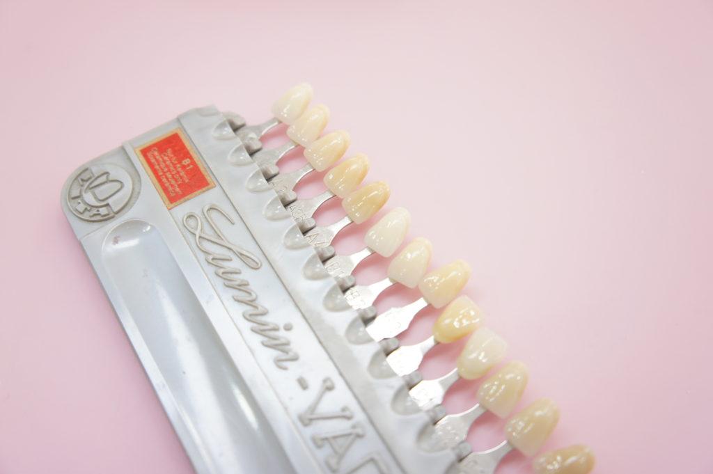 辻堂駅のホワイトニング おすすめポイントや口コミも紹介