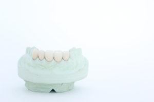 人工歯の色・形・大きさってどうやって選ぶの？選び方基準